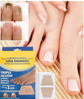 Parches para hongos y cuidado de las uñas + Regalo